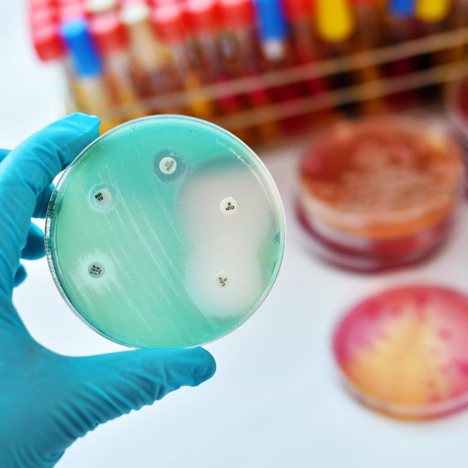 30Pcs Petri Dishes Plastic Cle - Agar Tissue Culture บทวิจารณ์และราคา